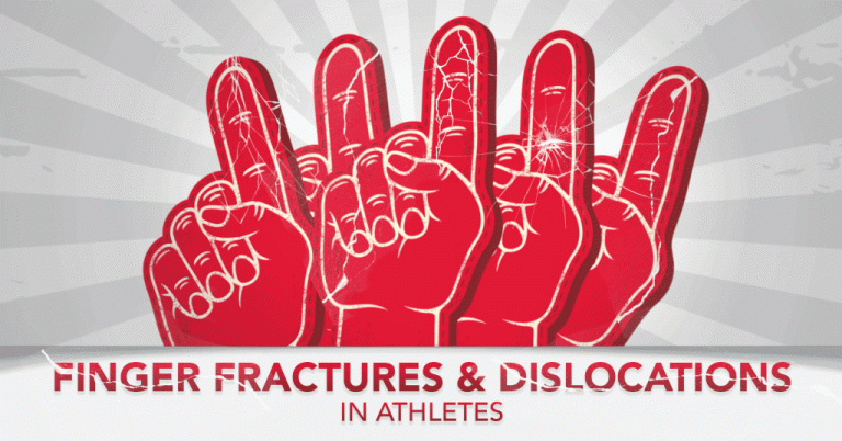 Finger Fractures and Dislocations in Athletes