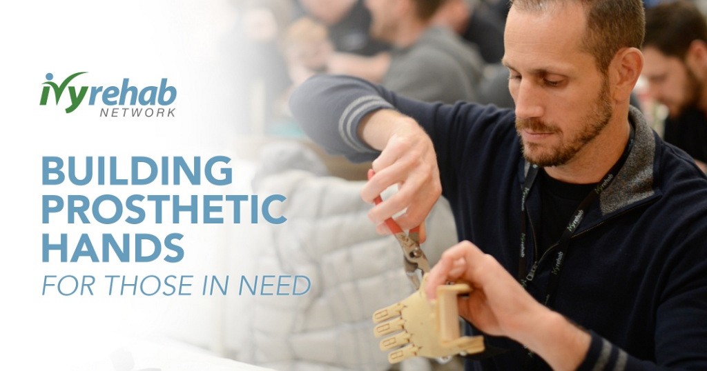 Man fixing building prosthetic hand