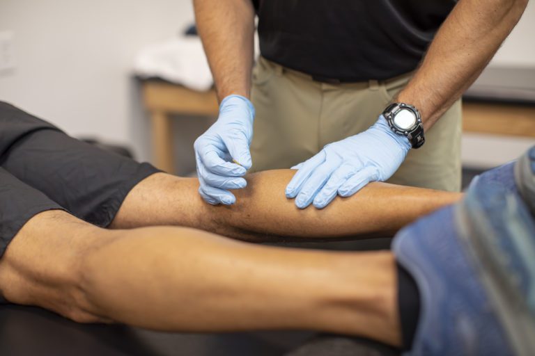 Dry Needling – What is it?